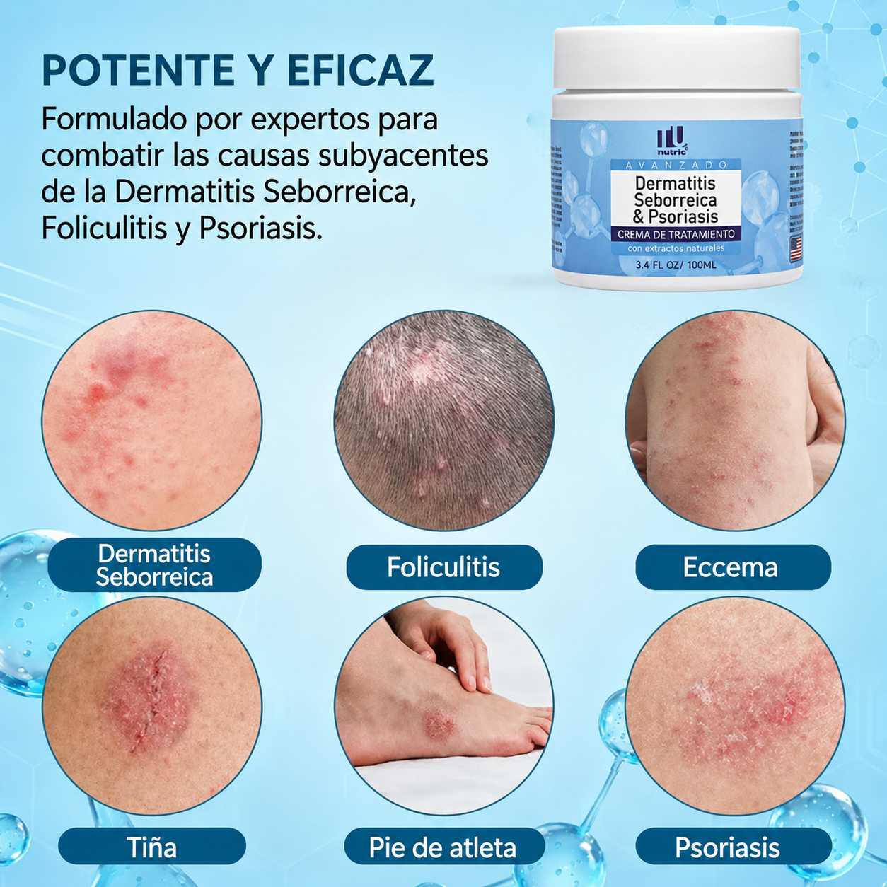 Roycederm™ Tratamiento Herbal Avanzado 🌱