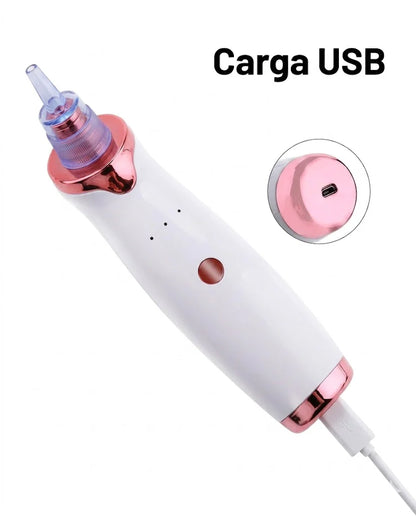 🧼 Extractor de Poros y Espinillas + 5 boquillas GRATIS 🎁