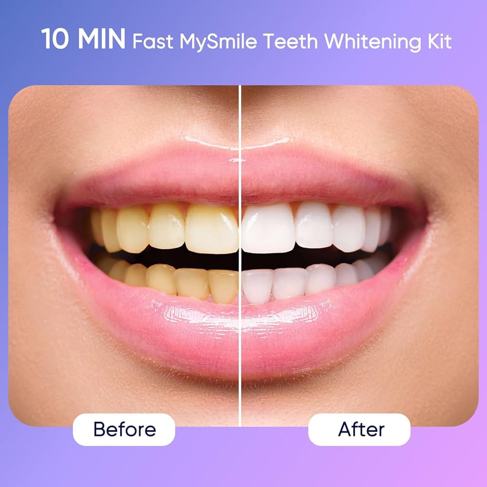 WhiteFlash Lápiz Blanqueador Dental Instantáneo 🦷