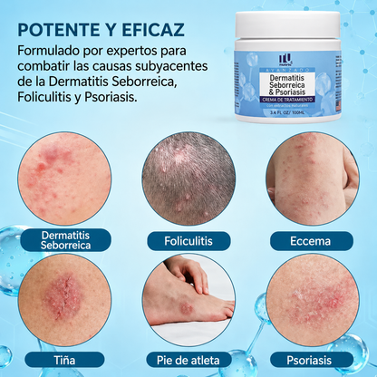 Roycederm™ Tratamiento Herbal Avanzado 🌱