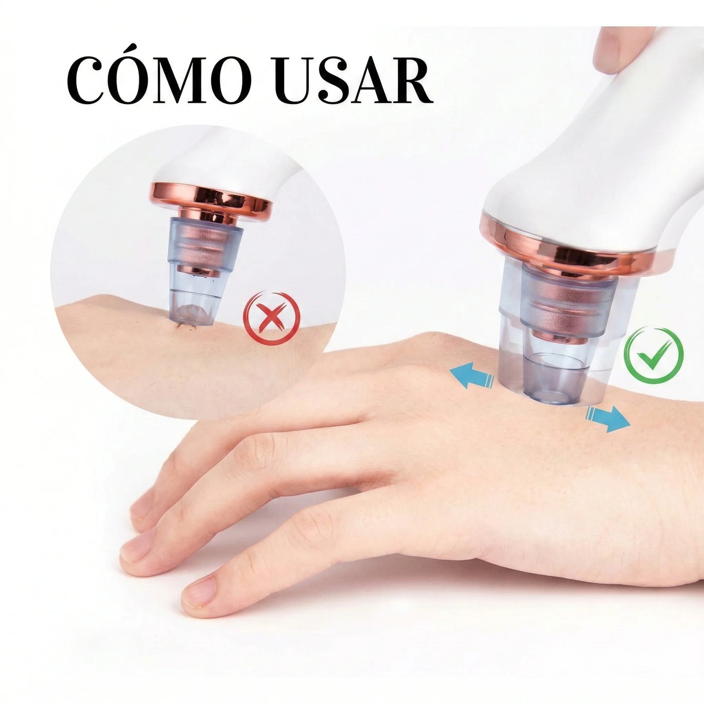 🧼 Extractor de Poros y Espinillas + 5 boquillas GRATIS 🎁
