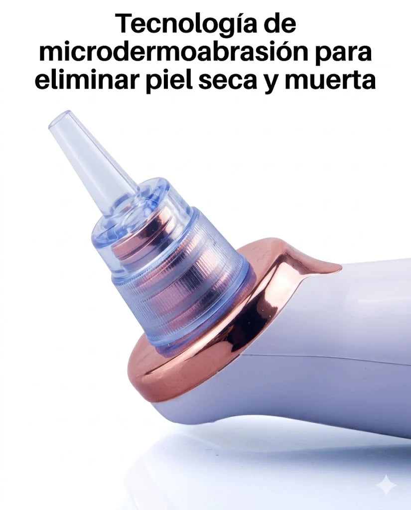 🧼 Extractor de Poros y Espinillas + 5 boquillas GRATIS 🎁