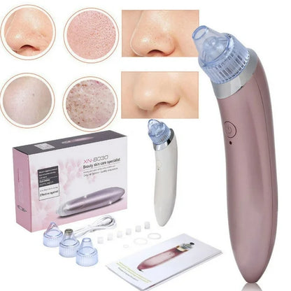 🧼 Extractor de Poros y Espinillas + 5 boquillas GRATIS 🎁