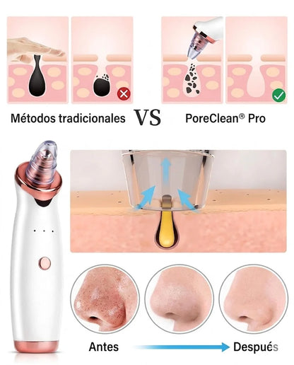 🧼 Extractor de Poros y Espinillas + 5 boquillas GRATIS 🎁