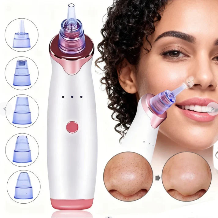 🧼 Extractor de Poros y Espinillas + 5 boquillas GRATIS 🎁